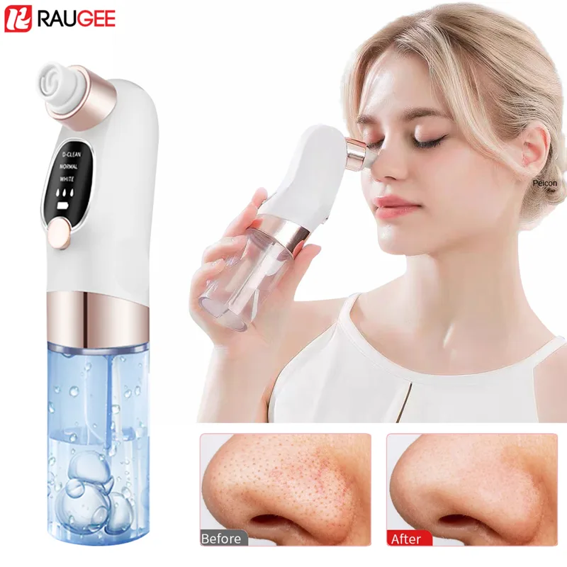 Air Bubble Remover - Extractor de espinillas eléctrico, aspiradora de