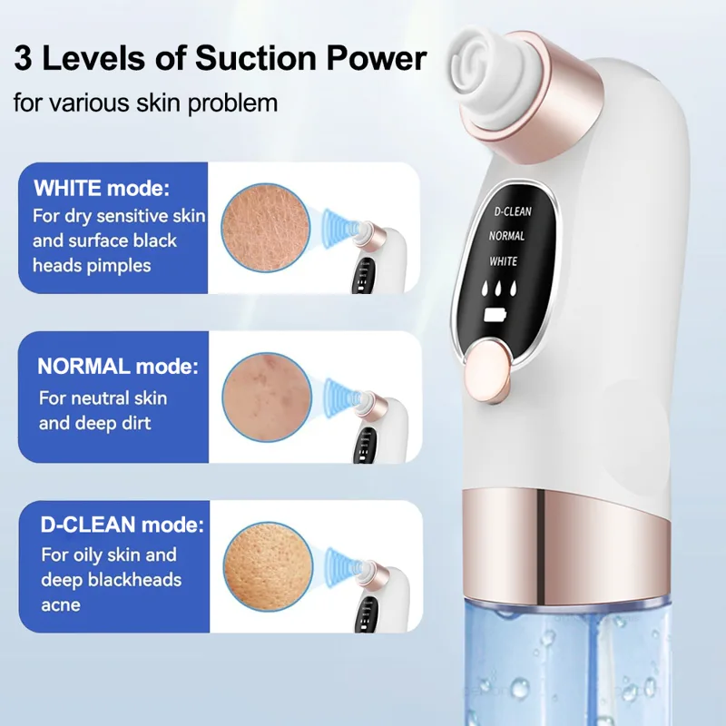 Extractor de espinillas eléctr - Air Bubble Remover reseña y precio